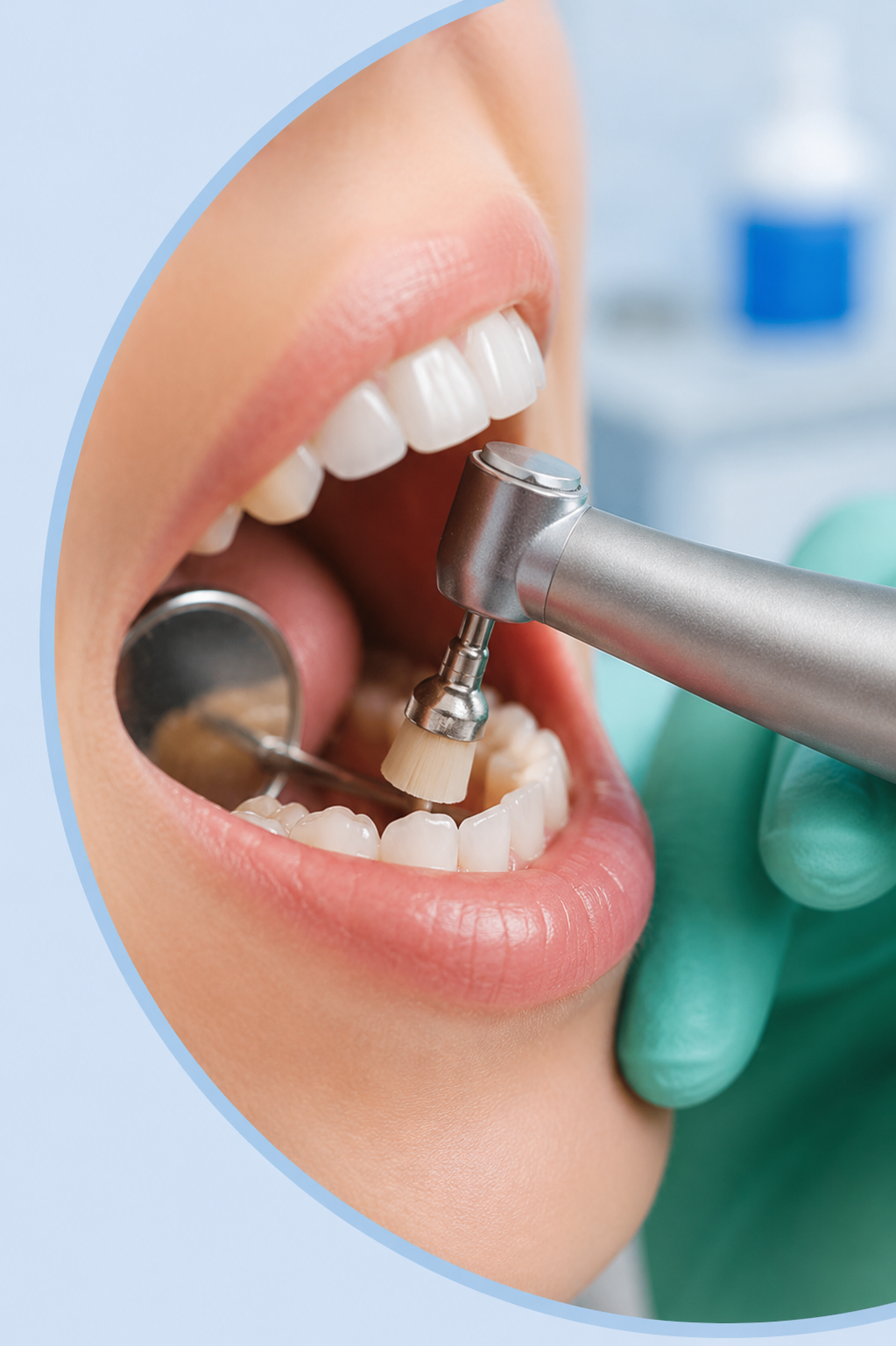 Caries et soins conservateurs