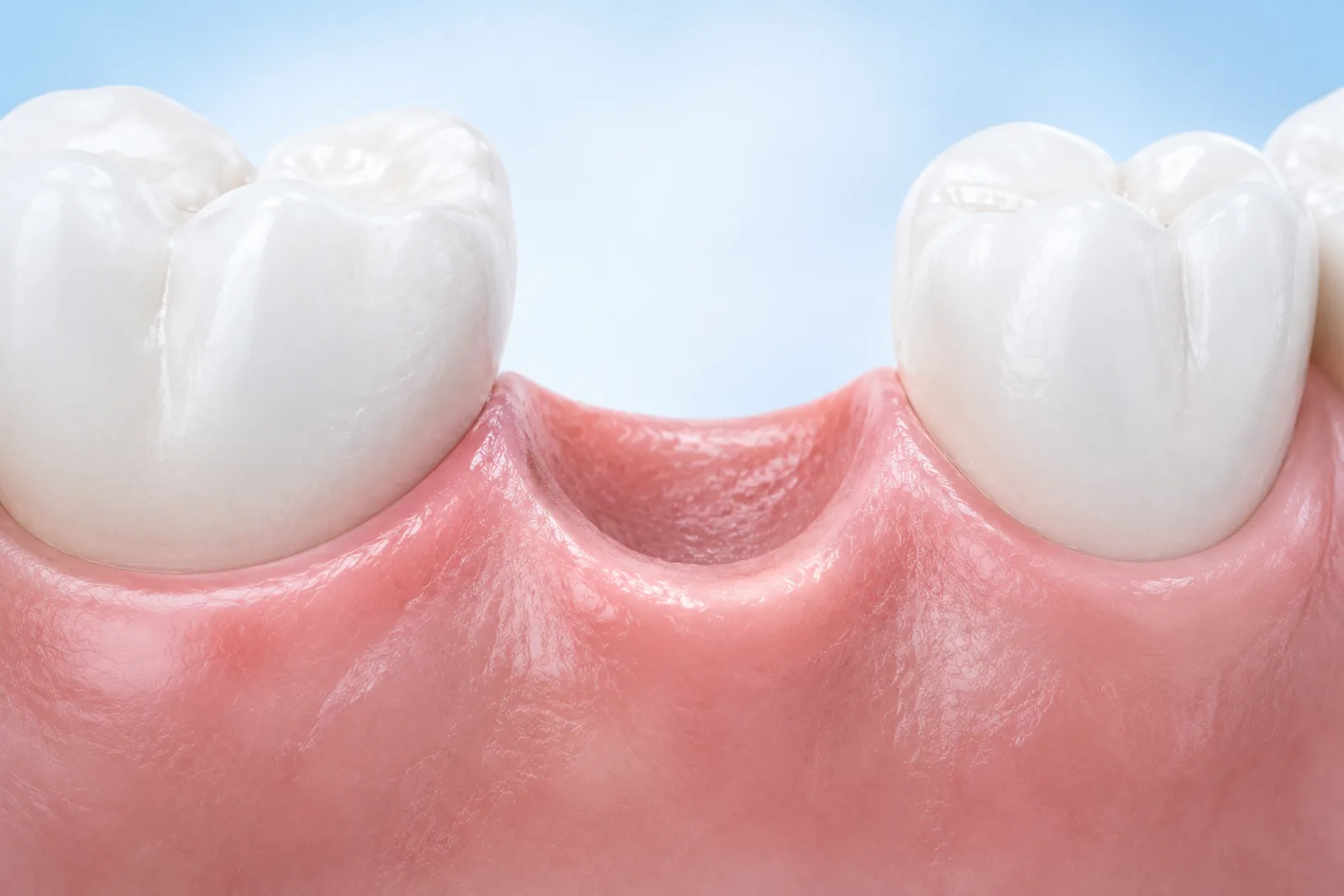 Cicatrisation après extraction : combien de temps faut-il ?